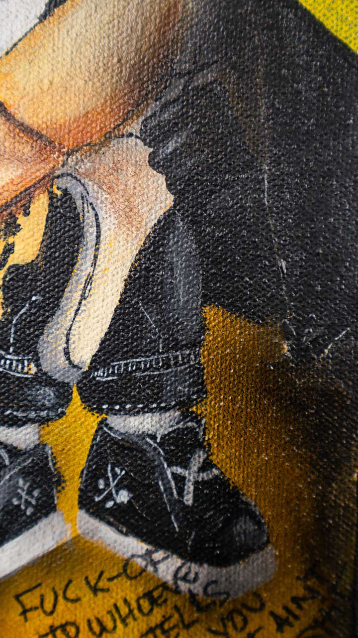 Warhol's Scars — detail view, original acrylic painting by Mads Suquet